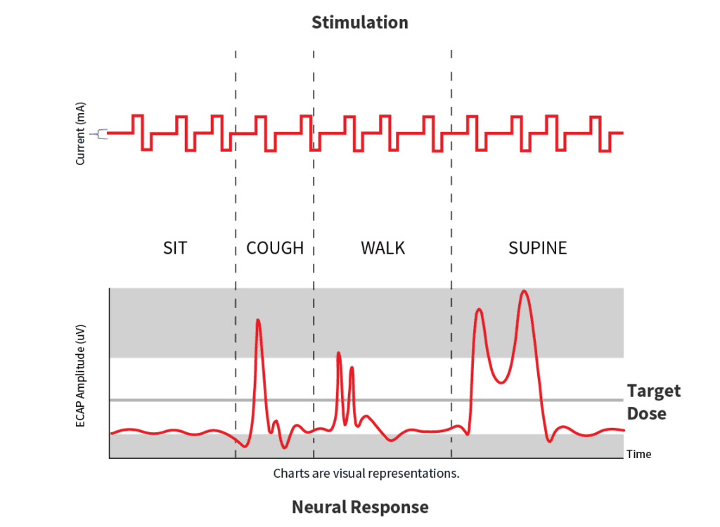 fixed output spinal cord stimulation 